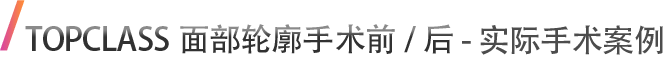 TOPCLASS面部轮廓手术前/后 - 实际手术案例