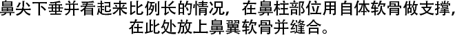鼻尖下垂并看起来比例长的情况，在鼻柱部位用自体软骨做支撑，在此处放上鼻翼软骨并缝合。