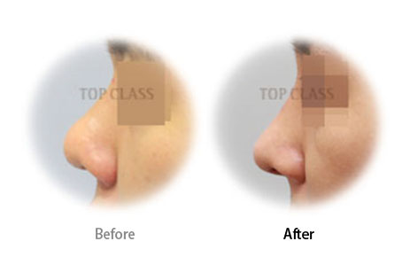 Case10 Before and After