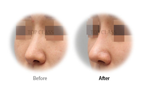 Case02 Before and After