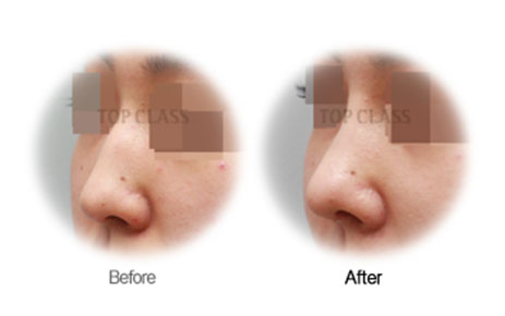 Case03 Before and After