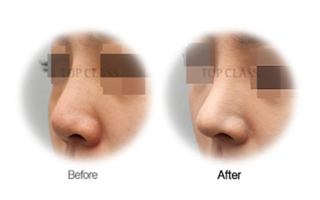 Case01 Before and After