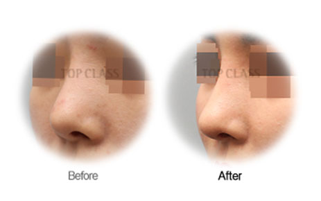 Case02 Before and After