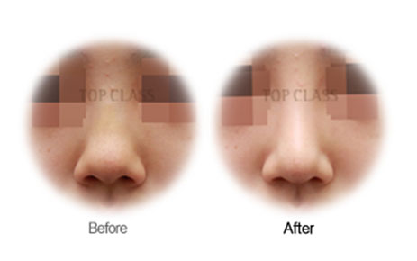 Case03 Before and After