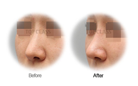 Case04 Before and After