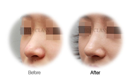 Case07 Before and After