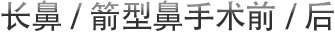 长鼻/箭型鼻手术前/后