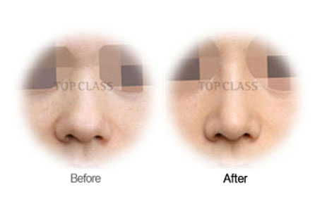 Case03 Before and After