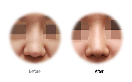 Case04 Before and After