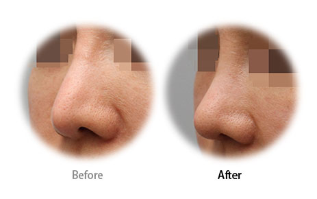 Case05 Before and After