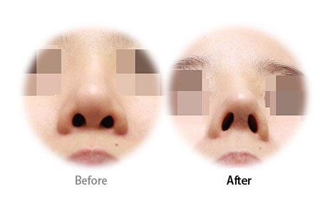 Case02 Before and After