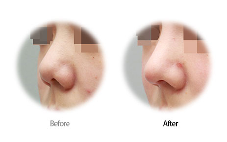 Case04 Before and After