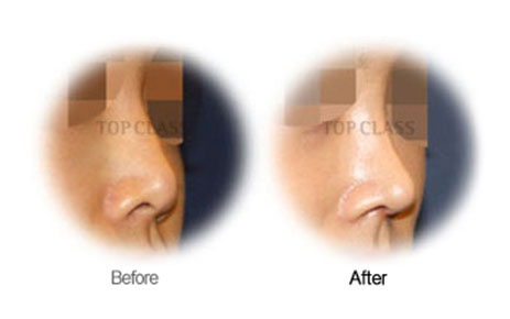 Case09 Before and After