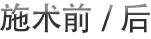 施术前/后
