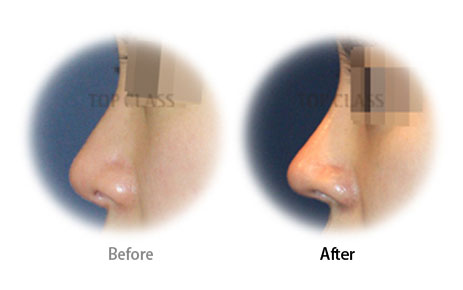 Case01 Before and After