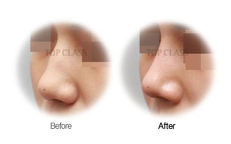 Case02 Before and After