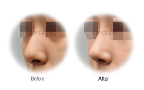 Case04 Before and After