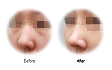Case04 Before and After