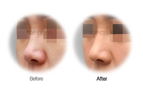 Case02 Before and After