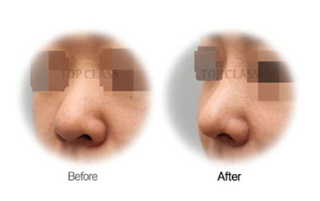 Case04 Before and After