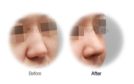 Case02 Before and After