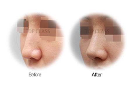 Case03 Before and After