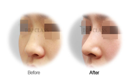 case08 Before and After