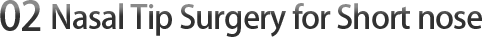 02 Nose Tip Surgery for Lifted Nose