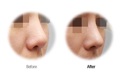 Case06 Before and After