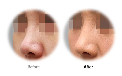 Case06 Before and After