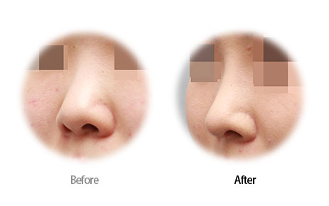 Case05 Before and After