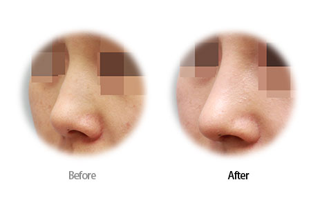 Case07 Before and After