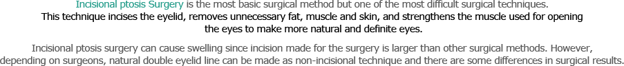 Incisional ptosis Surgery is the most basic surgical method but one of the most difficult surgical techniques. This technique incises the eyelid, removes unnecessary fat, muscle and skin, and strengthens the muscle used for opening the eyes to make more natural and definite eyes. Incisional ptosis surgery can cause swelling since incision made for the surgery is larger than other surgical methods. However, depending on surgeons, natural double eyelid line can be made as non-incisional technique and there are some differences in surgical results. 