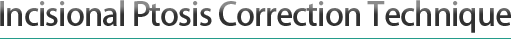 Incisional Ptosis Correction Technique