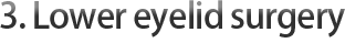 Lower Eyelid Surgery