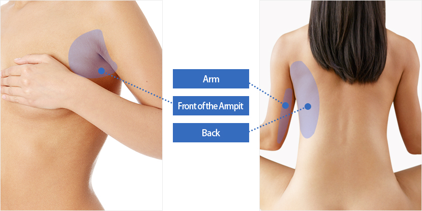 Arm, Front of the Armpit, Back