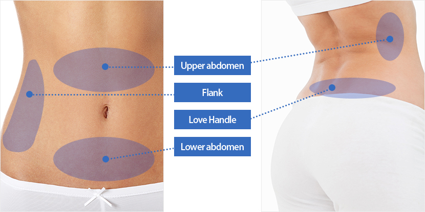 Upper Stomach, Flank, Love Handle, Lower Stomach